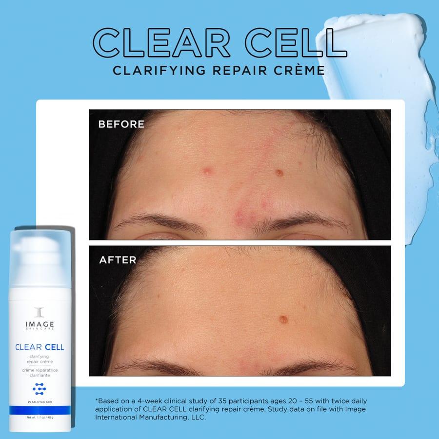 Clinical example for IMAGE Skincare CLEAR CELL clarifying repair creme