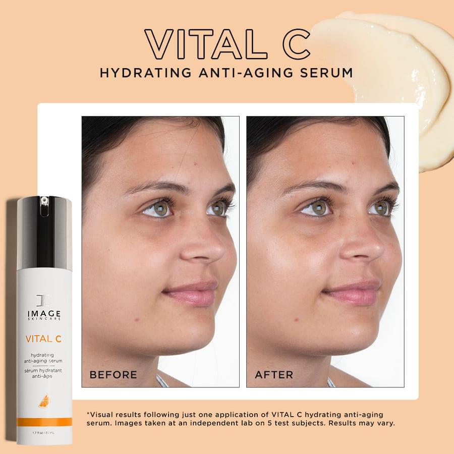 Before and after example for IMAGE Skincare VITAL C serum