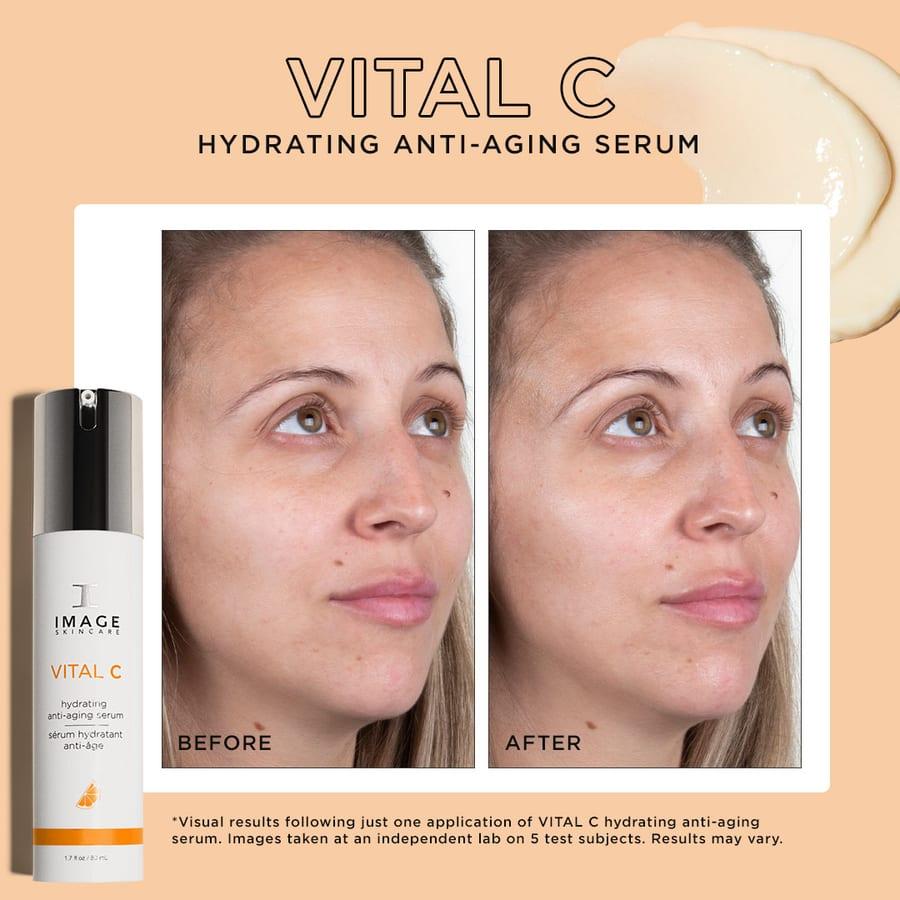 Before and after example for IMAGE Skincare VITAL C hydrating serum