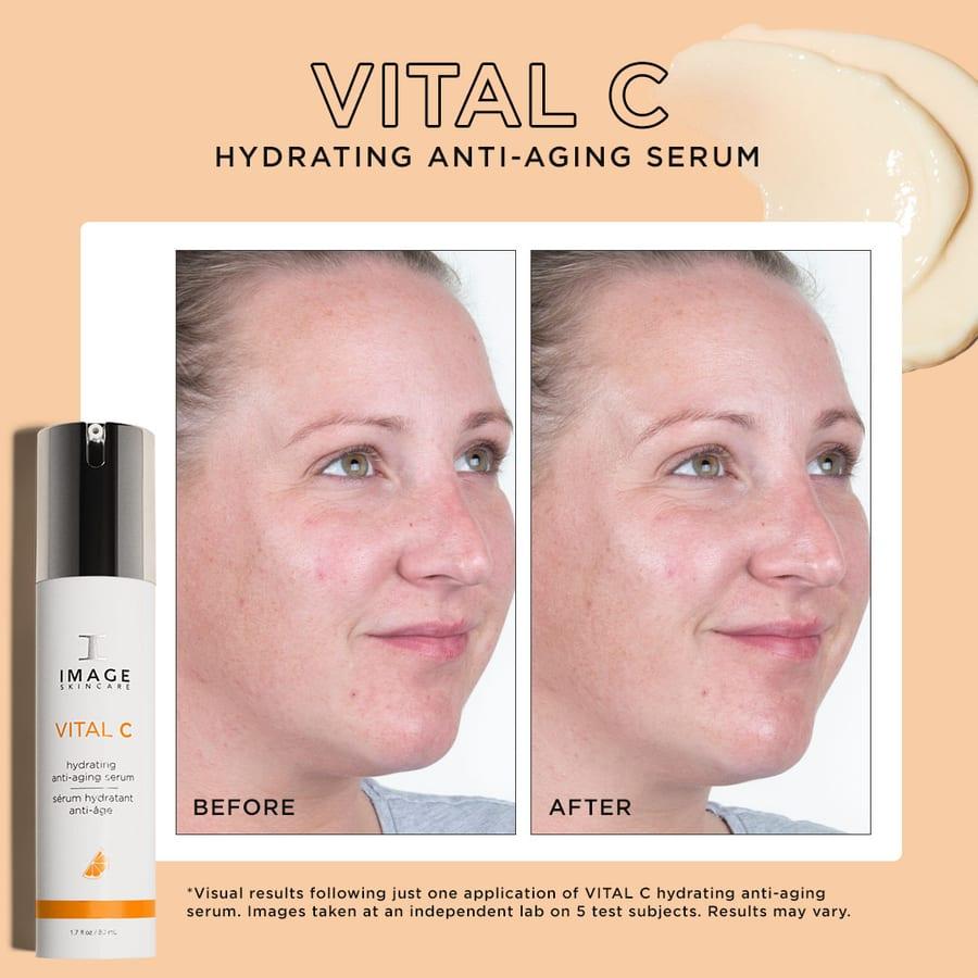 Before and after example for IMAGE Skincare VITAL C anti-aging serum
