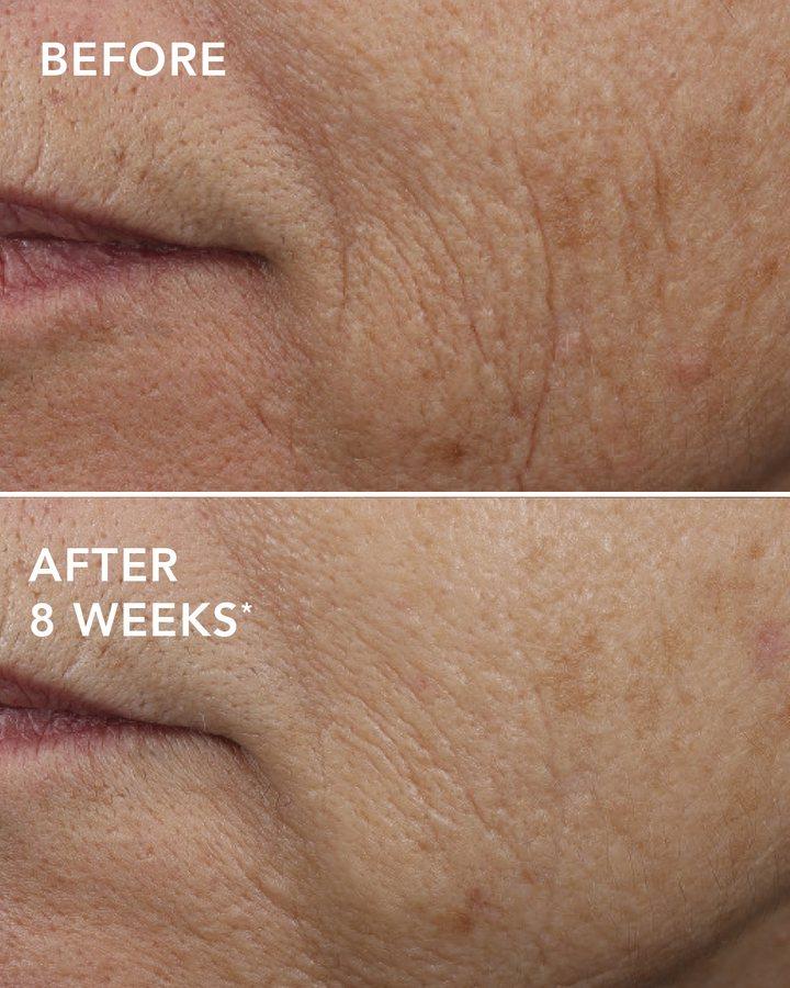 Before and after example for AGELESS+ overnight masque 0.5%