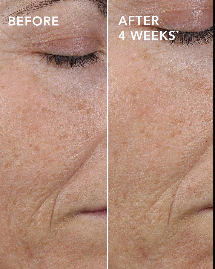 Before and after example for AGELESS+ pure liquid retinol 0.3%