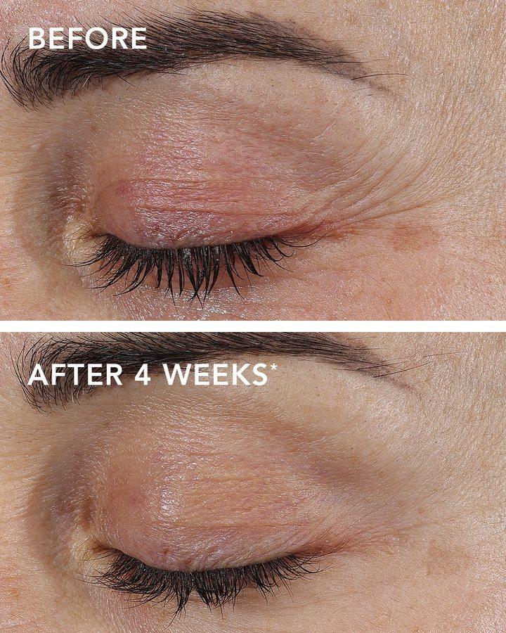 Before and after example for AGELESS+ repair creme 0.3%