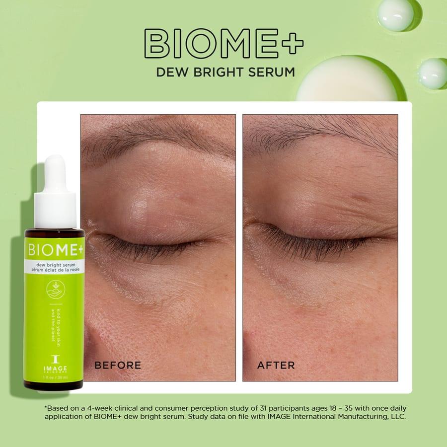 Clinical example for IMAGE Skincare BIOME+