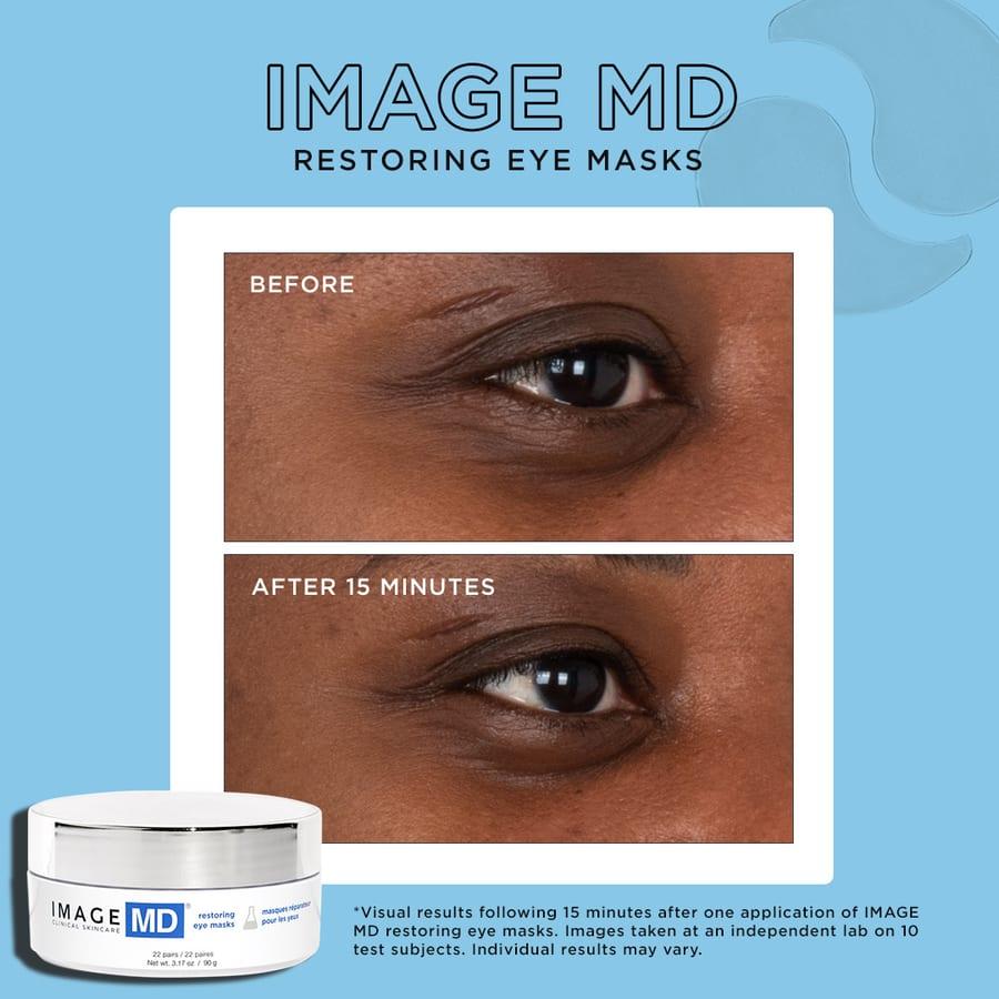 Before and after example for IMAGE MD restoring eye masks
