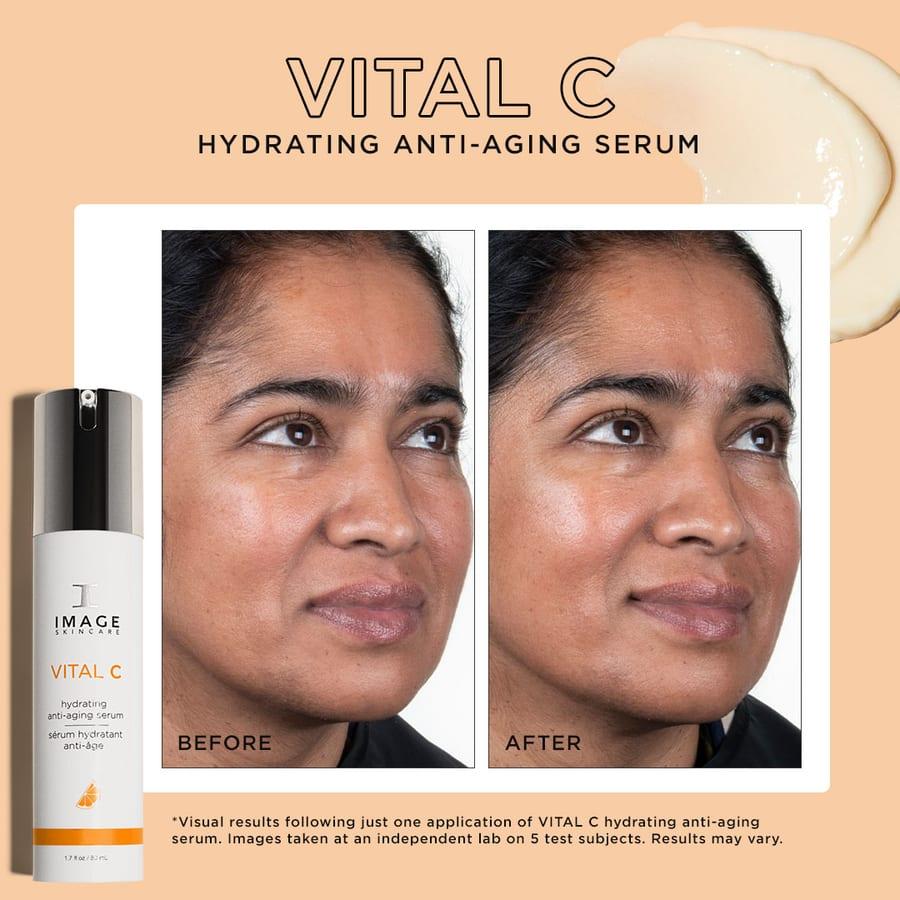 Before and after example for IMAGE Skincare VITAL C