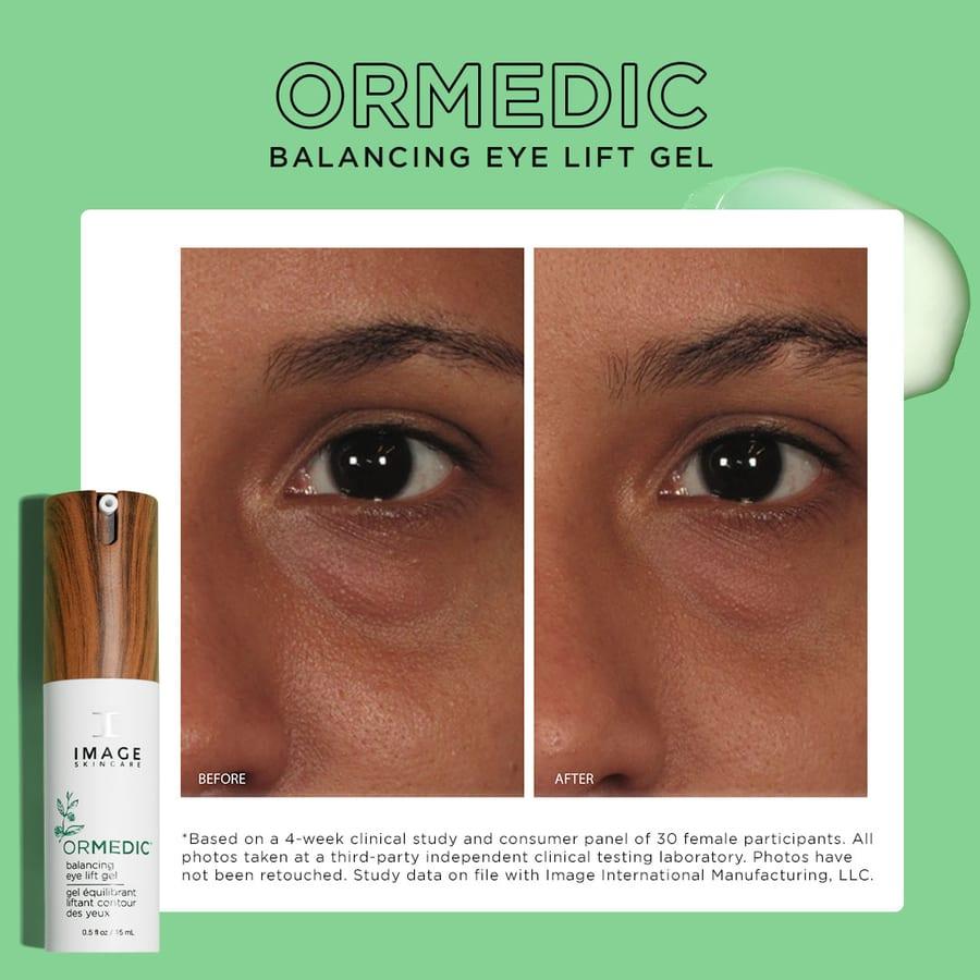 Before and after example for IMAGE Skincare ORMEDIC eye lift gel