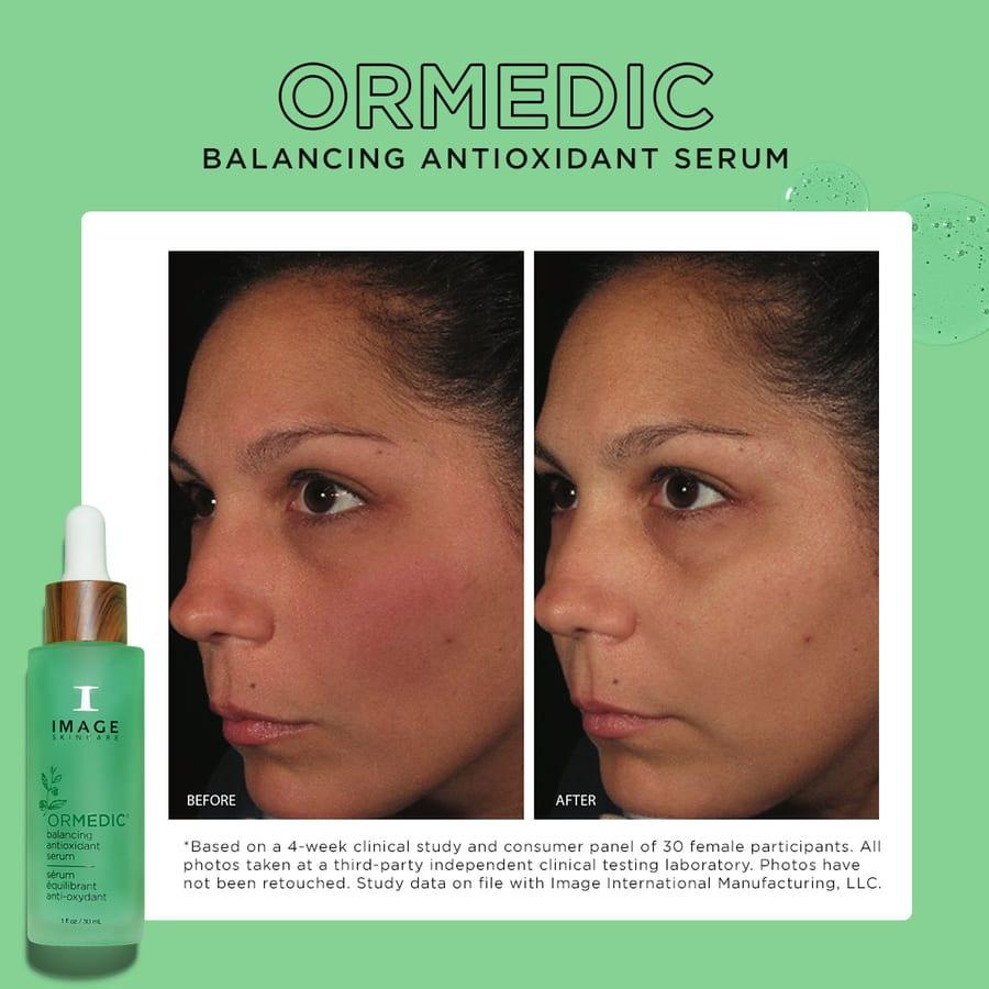 Before and after example for IMAGE Skincare ORMEDIC balancing antioxidant serum